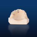 lithium dedilicate cad ແຂ້ວປອມແປງການຟື້ນຟູ